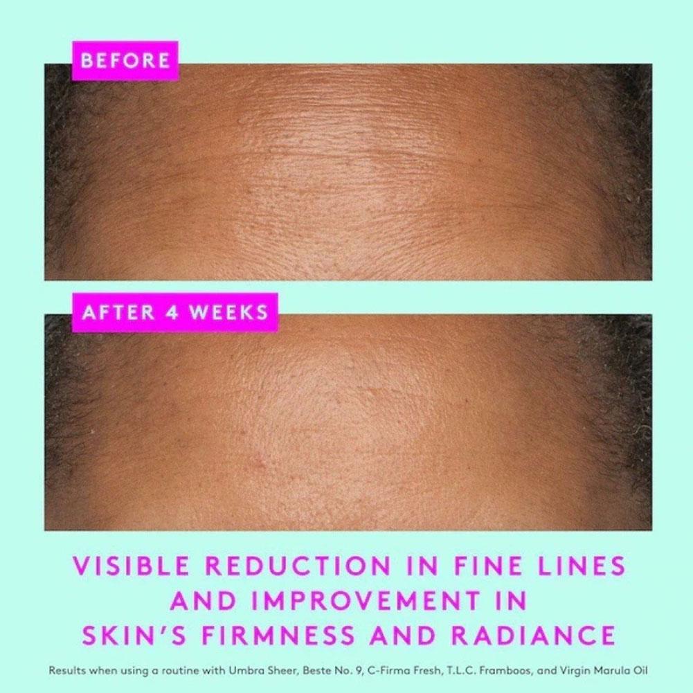 Creme Hidratante Facial Protini® Melhora a elasticidade da pele